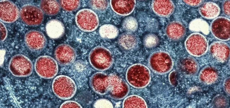 Em cenário de emergência mundial, Bahia registra 38 casos de mpox em 2024