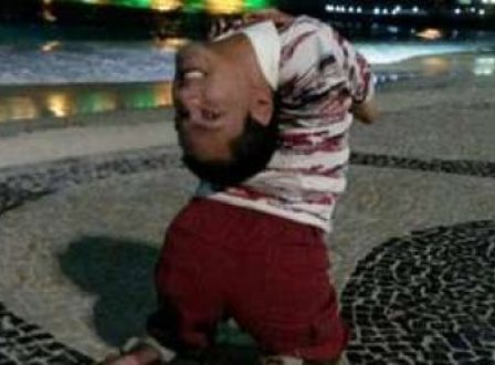 Monte Santo: Baiano de 37 anos nasceu com a cabeça virada para baixo