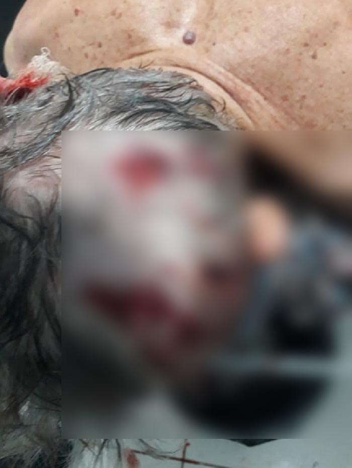 Casal de idosos é torturado após ter residência invadida por assaltantes na zona rural em Rio do Antônio 