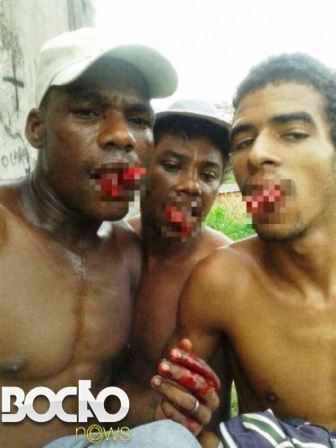 Salvador: Cena de terror, traficantes fazem supostos ladrões comerem os próprios dedos