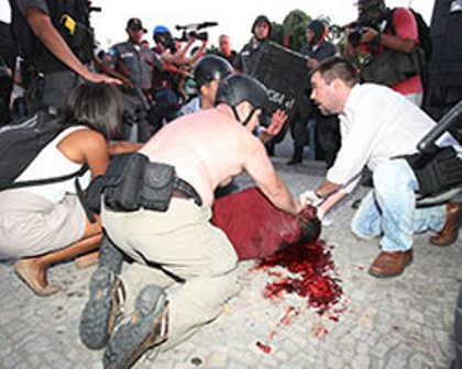 Rio de Janeiro: Cinegrafista é internado após ser atingido por bomba em protesto 