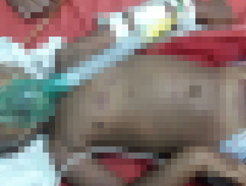 Em Barra da Estiva criança de dois anos está em estado grave após suposta tortura por parte do padrasto