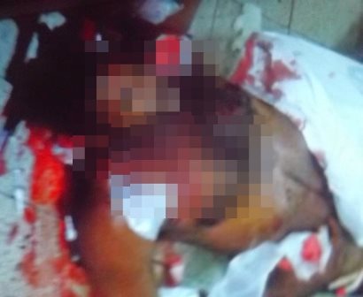 Homens invadem o Hospital Clériston Andrade e matam paciente