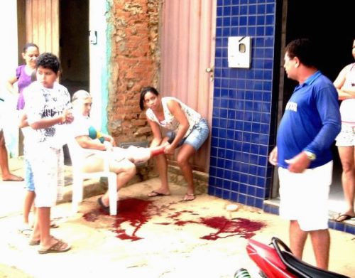 Mulher é atacada por cão feroz e salva por popuplares