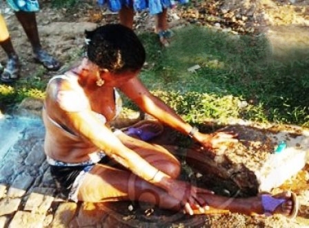 Irecê: Mulher ateia fogo no próprio corpo