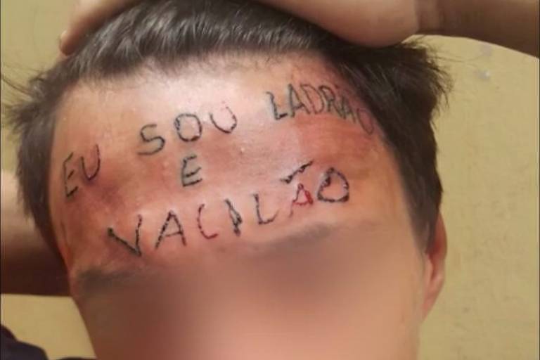 Jovem que teve testa tatuada é preso por furtar desodorantes em SP