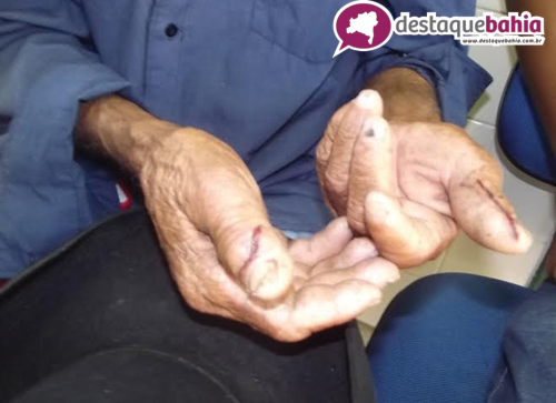 Aposentado entra em luta corporal com bandidos e por pouco não morre