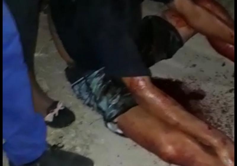 Brumado: Suposta 'guerra entre traficantes' resulta em tiroteio no Bairro Dr. Juracy, três homens foram baleados