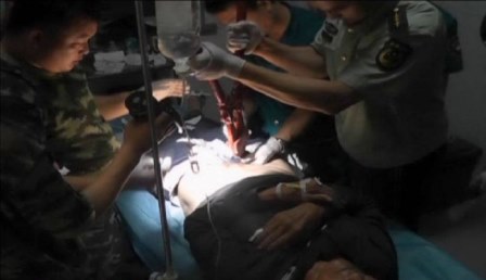 Com anel preso no pênis, idoso é socorrido por médicos e bombeiros