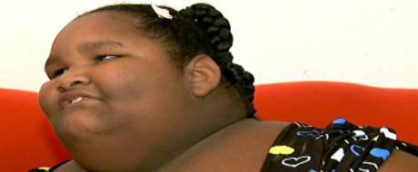 Família busca solução para caso de menina de 9 anos que pesa 113 kg