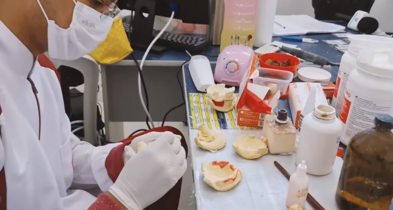 Programa de prótese dentária da prefeitura de Aracatu completa três meses com 150 próteses realizadas 