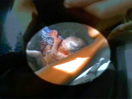 Grávida não acha vaga em hospital e tem filho dentro de carro