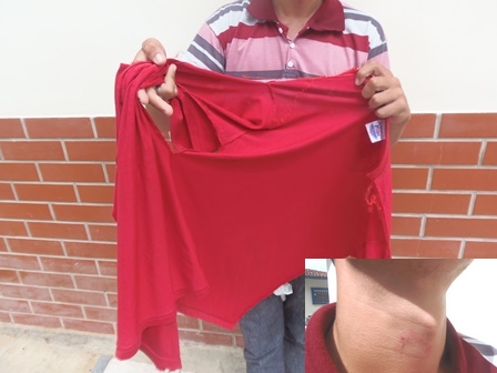 Por ciúmes rapaz tenta estrangular menor em Itaquarai 