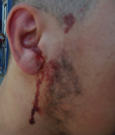 Violência: Jovem é brutalmente espancado por três rapazes em frente a sua residência