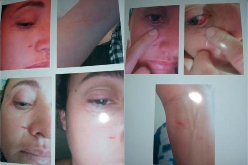 Mulher é agredida pelo genitor de sua filha após cobrar pensão alimentícia em Livramento de Nossa Senhora