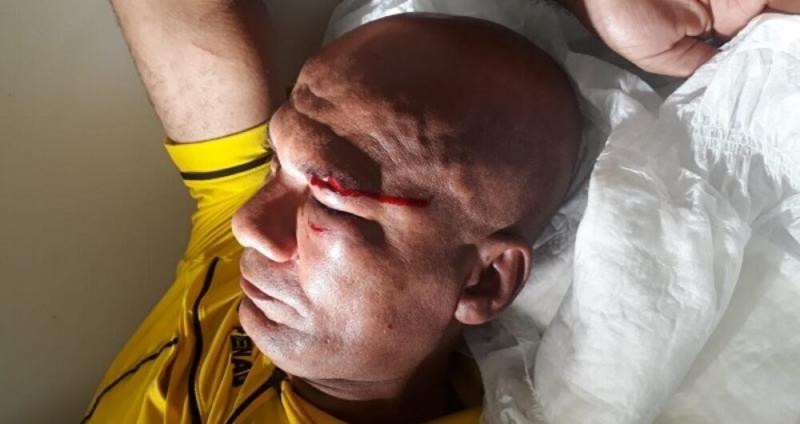 Jogador agride árbitro de futebol em campeonato amador disputado em Ipiaú