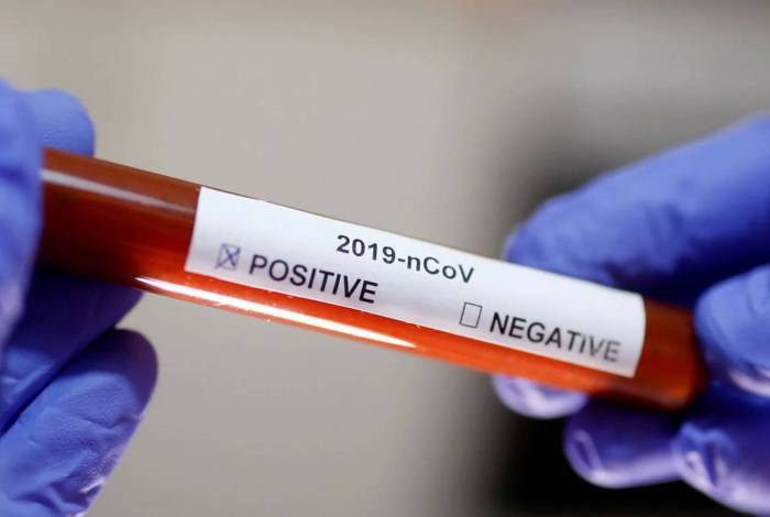 Bahia: Confirmado mais três casos de Covid-19, subsecretária de Saúde afirma, novos casos são importados