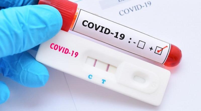 Bahia registra 14.204 casos confirmados de coronavírus (Covid-19)