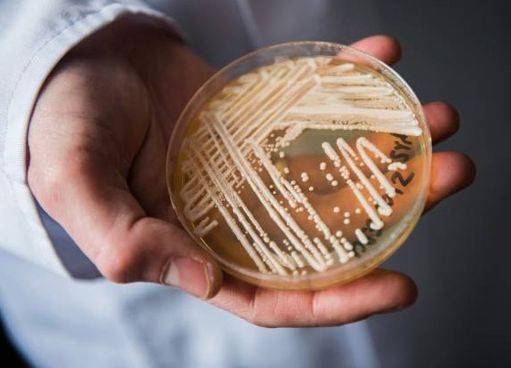 Anvisa alerta sobre 1º caso de infecção por superfungo no Brasil; caso ocorreu na Bahia