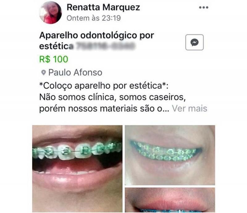 Bahia: falsa dentista que anunciava serviços odontológicos por redes sociais é presa