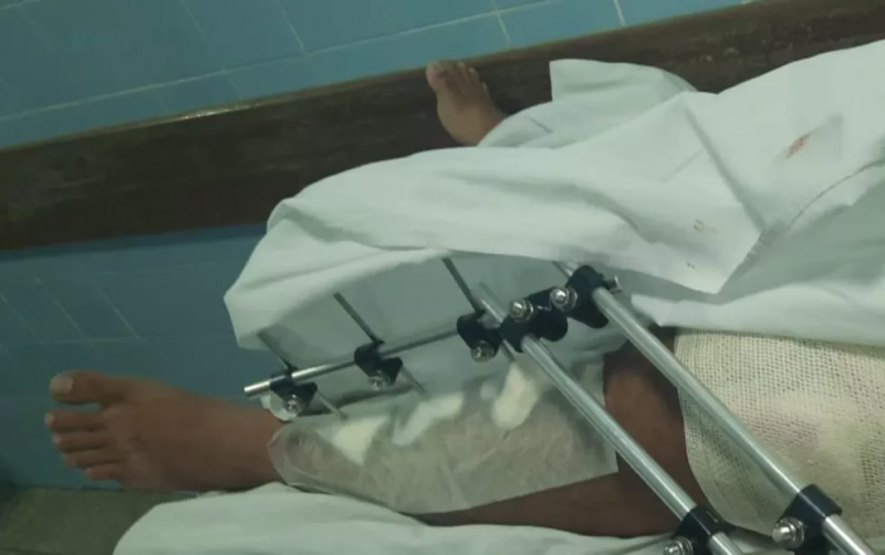 Guanambi: Inquérito vai apurar ação de policiais contra homem que tem esquizofrenia