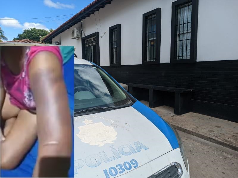 Mulher é mantida por três dias em cárcere privado por 3 dias em Brumado; vítima foi agredida com foice