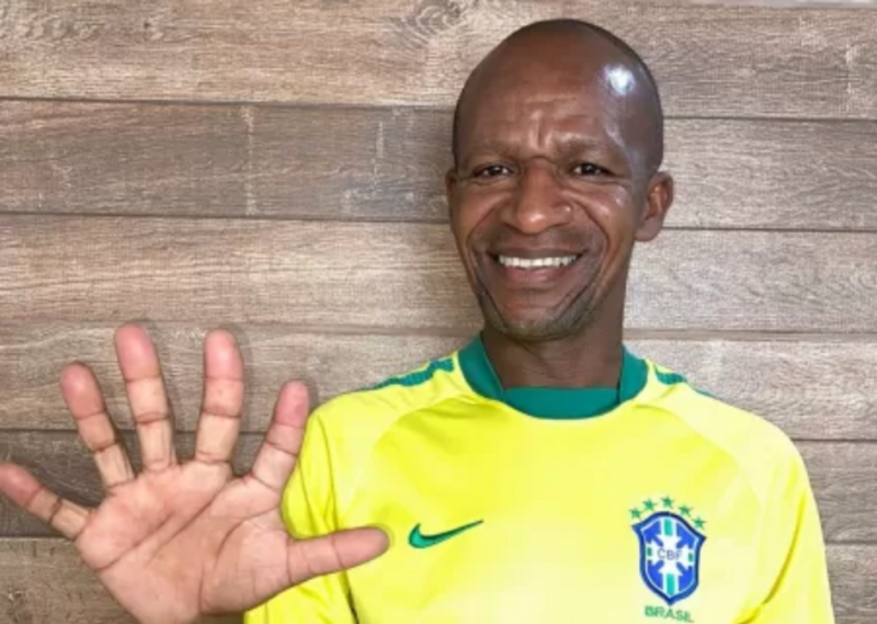 Hexa? Baiano com 6 dedos faz sucesso e vira alvo de grandes empresas