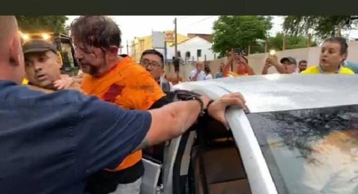 Senador licenciado cid Gomes baleado no tórax está consciente e em evolução clínica, diz boletim médico