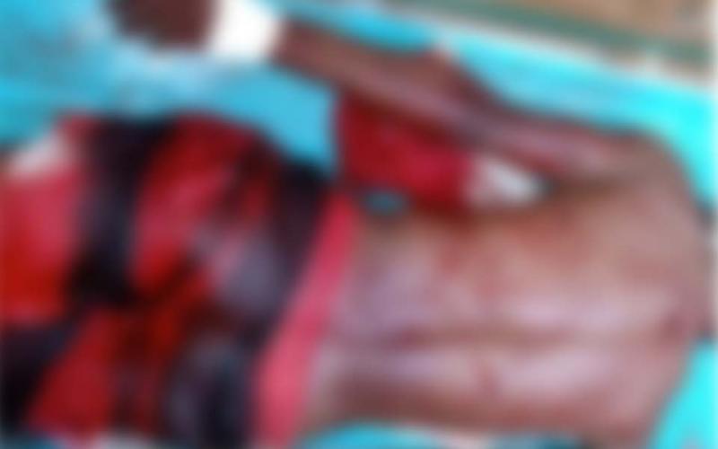 Homem é esfaqueado durante tentativa de homicídio em Barra da Estiva