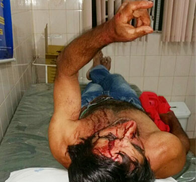 Lavrador é espancado na frente da esposa durante assalto em Barra da Estiva