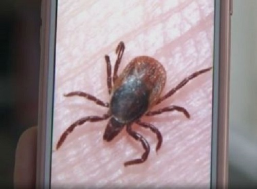 Criança é internada com suspeita de febre maculosa em Feira de Santana