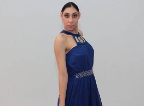 Jovem com microcefalia vira modelo após ser desacreditada por médicos