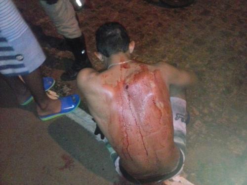 Homem sofre tentativa de homicídio próximo a linha férrea, na Rua Da Estação