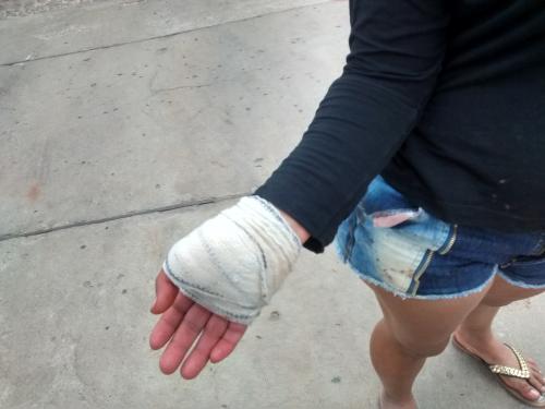 Casal sofre tentativa de homicídio na Fazenda Riachao, zona rural de Brumado