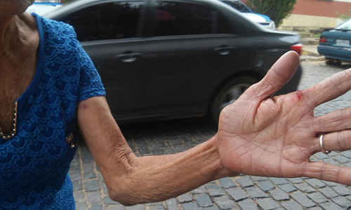 Idosa de 76 anos foi agredida na zona rural de Brumado 