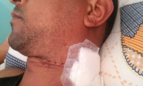 Homem quase tem pescoço decepado por linha de cerol no bairro Baraúnas em Brumado