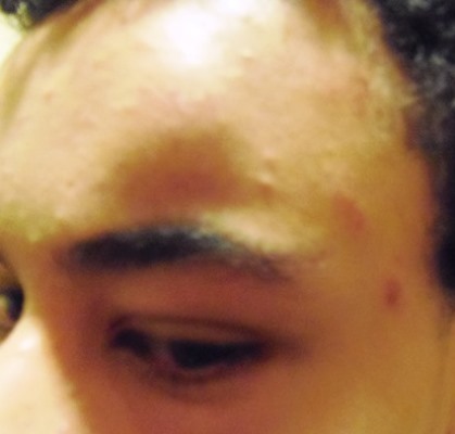 Violência: Menor é agredido brutalmente e tem celular roubado