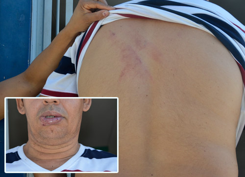 Casal relata momento vivido em poder de assaltante em Brumado