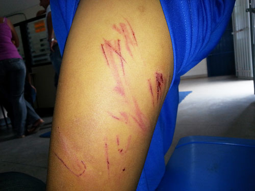 Violência Doméstica: Criança de 08 anos é agredida com mangueira por comer o pão do irmão