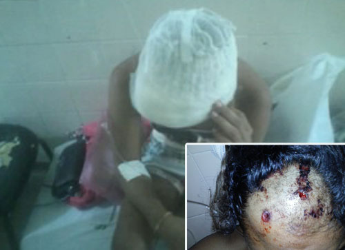 Jovem alvejada na cabeça passou por neurologista no Hospital de Base em Vitória da Conquista