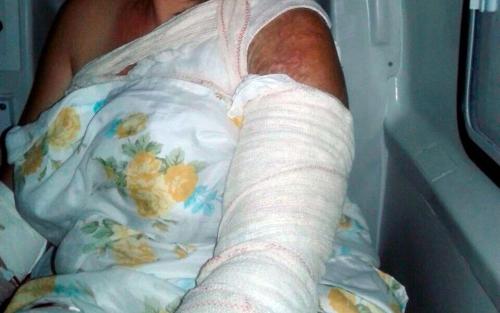 Justiça decreta prisão preventiva de ex-vereador suspeito de mandar jogar ácido na ex-cunhada