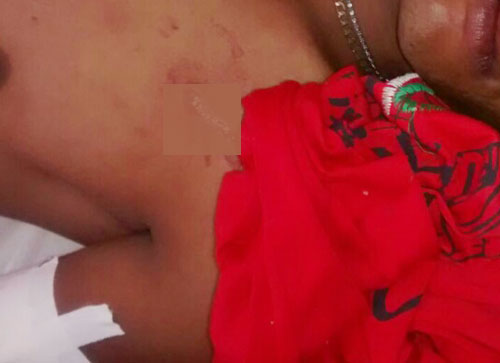 Discussão em bar no Bairro Alto México quase resulta em morte