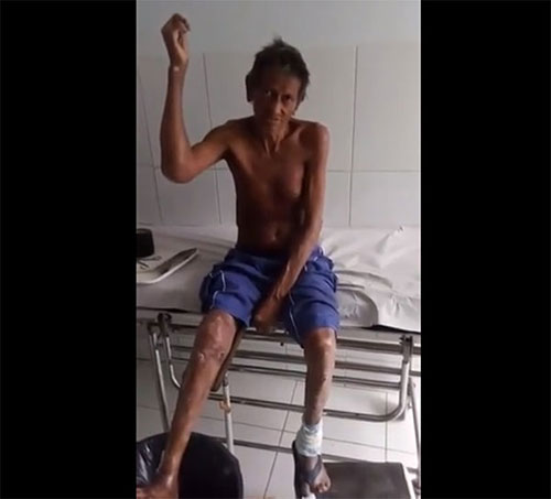 lavrador denuncia Secretaria Municipal de Rio do Ant?nio por descaso com seu tratamento de Hansen?ase 