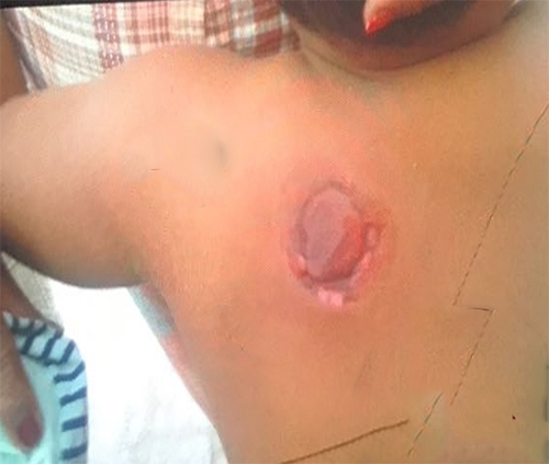 Criança é atacada e mordida por jumento na zona urbana de Guanambi
