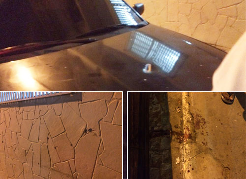 Homem é atingido na cabeça durante tentativa de homicídio em Livramento