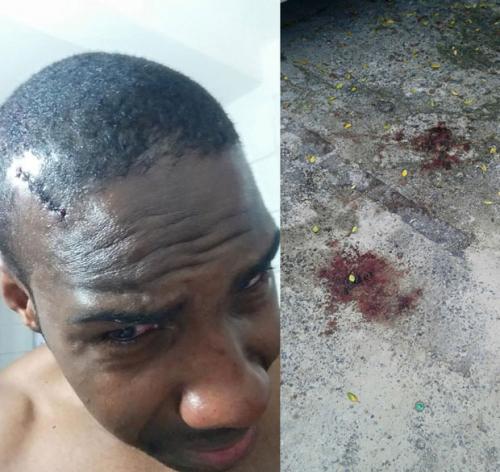 Jornalista acusa PMs de agressão; ele levou oito pontos na cabeça