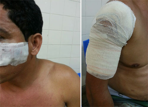 Achando que estava sendo traído, homem efetua cinco tiros no suposto amante da esposa