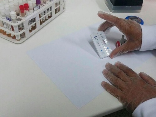 Lançado na BA, teste rápido nacional da zika dará resultado em 20 minutos