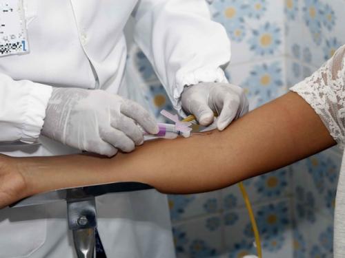 Testes rápidos detectam 21 casos de HIV nos circuitos do carnaval na Bahia