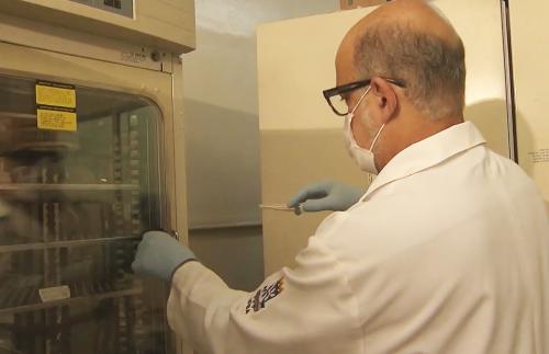 Doença da urina preta tem semelhanças com casos antigos do AM, Europa e EUA